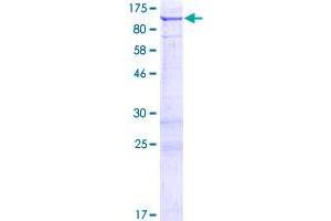 Image no. 1 for Coiled-Coil Serine-Rich Protein 2 (CCSER2) (AA 1-538) protein (GST tag) (ABIN1308596) (FAM190B Protein (AA 1-538) (GST tag))