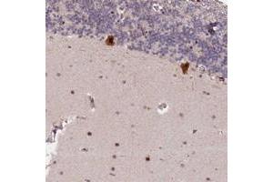 Immunohistochemical staining of human cerebellum with N4BP2L1 polyclonal antibody  shows strong cytoplasmic and nuclear positivity in purkinje cells at 1:50-1:200 dilution. (N4BP2L1 antibody)