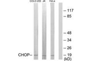 Western blot analysis of extracts from HeLa/Jurkat/COLO205 cells, using CHOP (Ab-30) Antibody. (DDIT3 antibody  (AA 15-64))