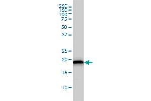 UBE2M monoclonal antibody (M01), clone 3C4 Western Blot analysis of UBE2M expression in Jurkat .