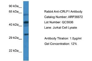 WB Suggested Anti-CRLF1 Antibody   Titration: 1. (CRLF1 antibody  (Middle Region))