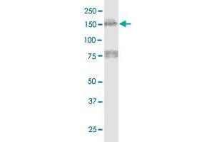 MTUS1 monoclonal antibody (M01), clone 1C7. (MTUS1 antibody  (AA 1-240))