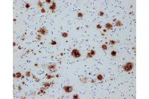Immunostaining of paraffin embedded sections from an Alzheimer's patient (dilution 1 : 200). (Abeta-pE3 antibody)