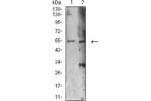 Western Blotting (WB) image for anti-Autophagy related 4C Cysteine Peptidase (ATG4C) (AA 321-458) antibody (ABIN5611292)