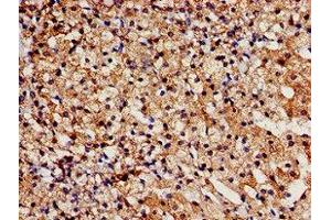 Immunohistochemistry analysis of human adrenal gland tissue using ABIN7171654 at dilution of 1:100 (TBC1D4 antibody  (AA 1-94))