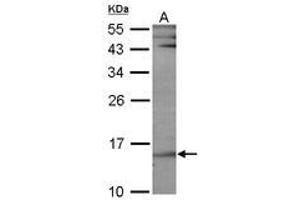 Image no. 1 for anti-Ubiquitin-Conjugating Enzyme E2B (UBE2B) (AA 7-152) antibody (ABIN467405) (UBE2B antibody  (AA 7-152))