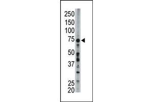 The anti-FACL6 Pab (ABIN389115 and ABIN2839301) is used in Western blot to detect FACL6 in mouse liver tissue lysate. (ACSL6 antibody  (AA 240-270))