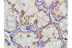 Immunohistochemistry (IHC) image for anti-Carcinoembryonic Antigen Gene Family (CEA) antibody (ABIN722946) (CEA antibody)