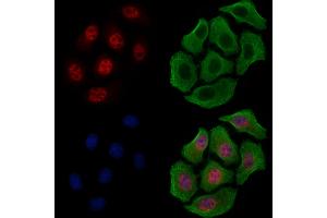 ABIN6255370 and ABIN6267631 staining HepG2 cells(4h of LPS treatment) by IF/ICC.