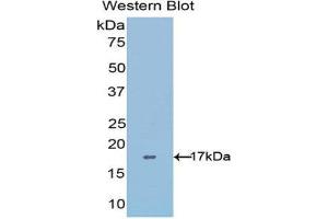 Western Blotting (WB) image for anti-ADAM Metallopeptidase with Thrombospondin Type 1 Motif, 4 (ADAMTS4) (AA 437-575) antibody (ABIN5662067) (ADAMTS4 antibody  (AA 437-575))