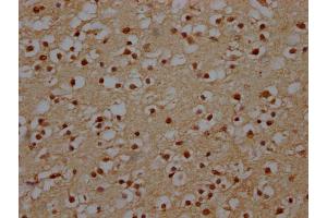 IHC image of ABIN7151088 diluted at 1:140 and staining in paraffin-embedded human brain tissue performed on a Leica BondTM system. (NHLRC1 antibody  (AA 86-395))