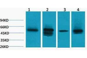 Western Blotting (WB) image for anti-Lactate Dehydrogenase D (LDHD) antibody (ABIN3181365) (LDHD antibody)