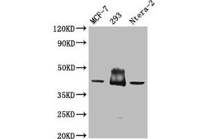 Western Blot Positive WB detected in: Mouse brain tissue All lanes: S1PR2 antibody at 3 μg/mL Secondary Goat polyclonal to rabbit IgG at 1/50000 dilution Predicted band size: 39 kDa Observed band size: 39 kDa (S1PR2 antibody  (AA 293-353))