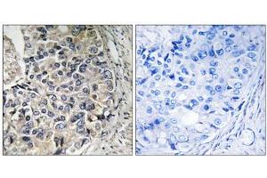 Immunohistochemistry analysis of paraffin-embedded human prostate carcinoma tissue using CMC1 antibody.