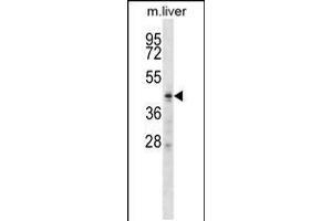 Western blot analysis in mouse liver tissue lysates (35ug/lane). (ZDHHC6 antibody  (C-Term))