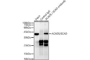 Immunoprecipitation analysis of 600 μg extracts of Mouse liver cells using 3 μg ACADS / SCAD antibody (ABIN7265419).