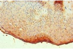 Immunohistochemistry of paraffin-embedded human skin tissue using ABIN7144533 at dilution of 1:100