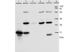 IP analysis of HPV-18 E7 protein. (HPV18 E7 antibody  (AA 36-70))