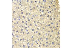 Immunohistochemistry of paraffin-embedded human liver injury using COMT antibody at dilution of 1:200 (400x lens). (COMT antibody)