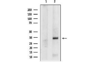 anti-N-Acetyltransferase 1 (Arylamine N-Acetyltransferase) (NAT1) (Internal Region) antibody