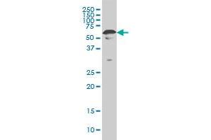 YY1 monoclonal antibody (M02), clone 4A5 Western Blot analysis of YY1 expression in Hela S3 NE . (YY1 antibody  (AA 221-320))