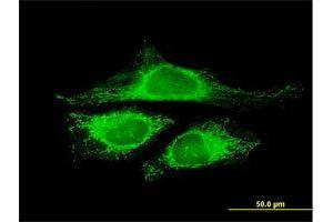 Immunofluorescence of purified MaxPab antibody to CRYZL1 on HeLa cell. (CRYZL1 antibody  (AA 1-113))