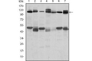 Western blot analysis using C-CBL mouse mAb against RAJI (1), RAW264. (CBL antibody)
