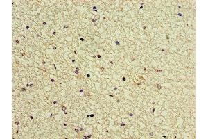 Immunohistochemistry of paraffin-embedded human brain tissue using ABIN7153807 at dilution of 1:100 (GTF2H5 antibody  (AA 1-71))