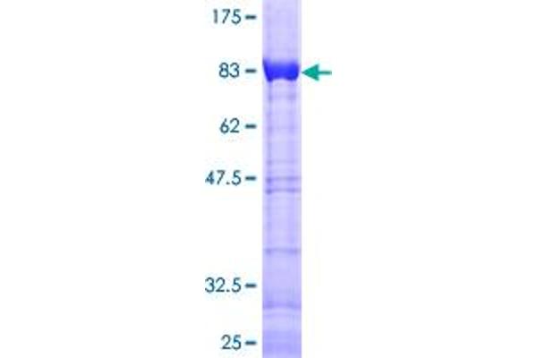 CACNB3 Protein (AA 1-484) (GST tag)