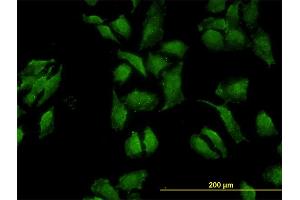 Immunofluorescence of monoclonal antibody to OCLN on HeLa cell.