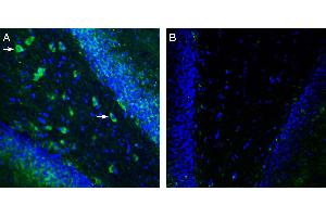 Expression of TRPM7 in rat hippocampus.