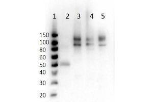 ODF2 anticorps  (pSer796)