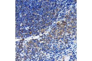 Immunohistochemistry of paraffin-embedded rat spleen using Bax antibody (ABIN7265858) at dilution of 1:100 (40x lens). (BAX antibody)