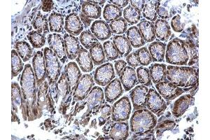 Immunohistochemistry (IHC) image for anti-Heterogeneous Nuclear Ribonucleoprotein K (HNRNPK) antibody (ABIN2855169)