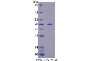 SDS-PAGE (SDS) image for Protein tyrosine Phosphatase, Non-Receptor Type 21 (PTPN21) (AA 981-1174) protein (His tag) (ABIN6239394) (PTPN21 Protein (AA 981-1174) (His tag))