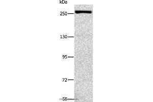 Western blot analysis of Raji cell, using ESPL1 Polyclonal Antibody at dilution of 1:500