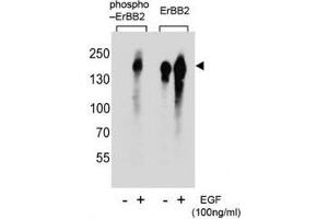 Western blot analysis of extracts from A431 cells, untreated or treated with EGF, using phospho-ERBB2 antibody (left) or nonphos Ab (right). (ErbB2/Her2 antibody  (pTyr1005))