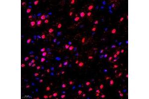 Immunofluorescence of paraffin embedded mouse brain using DMRTA2 (ABIN7073753) at dilution of 1: 650 (400x lens) (DMRTA2 antibody)