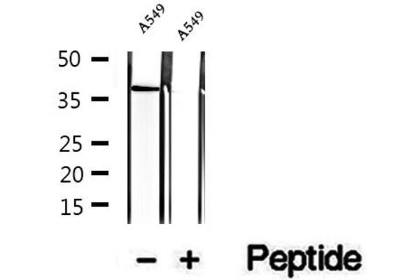 STBD1 antibody  (N-Term)