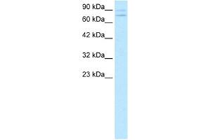 WB Suggested Anti-ZNF81 Antibody Titration:  0.