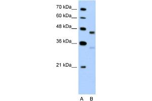 WB Suggested Anti-GPR161 Antibody Titration:  5.