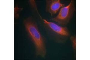 Immunofluorescence staining of methanol-fixed HeLa cells using IKK-β (Ab-199) Antibody (E021305, Red) (IKBKB antibody)