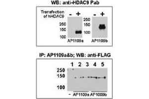 Both anti-HDAC9 N-term ((ABIN387960 and ABIN2844679)) and C-term ((ABIN387961 and ABIN2844680)) Pab were tested by WB and IP-WB using HeLa and HeLa-HDAC9 transfected cells. (HDAC9 antibody  (C-Term))