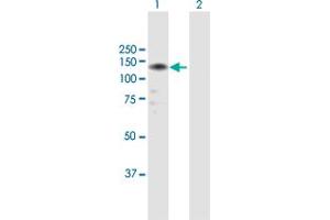 Western Blot analysis of LLGL2 expression in transfected 293T cell line by LLGL2 MaxPab polyclonal antibody.
