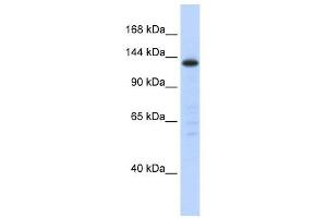 SF3B3 antibody used at 1 ug/ml to detect target protein. (SF3B3 antibody  (Middle Region))