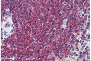 Human Spleen: Formalin-Fixed, Paraffin-Embedded (FFPE) (CA1 antibody  (AA 166-176))
