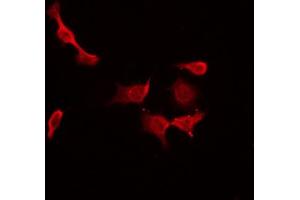 ABIN6274482 staining Hela by IF/ICC. (CIB3 antibody  (C-Term))