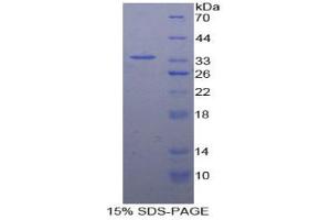 SDS-PAGE analysis of Human CNTNAP1 Protein.