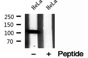 Western blot analysis of extracts of HeLa cells, using IPO4 antibody. (Importin 4 antibody  (Internal Region))