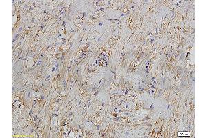 Formalin-fixed and paraffin embedded rat myocardium tissue labeled with Anti-Bcl-2 Polyclonal Antibody, Unconjugated (ABIN723920) 1:300 followed by conjugation to the secondary antibody and DAB staining (Bcl-2 antibody  (AA 101-160))